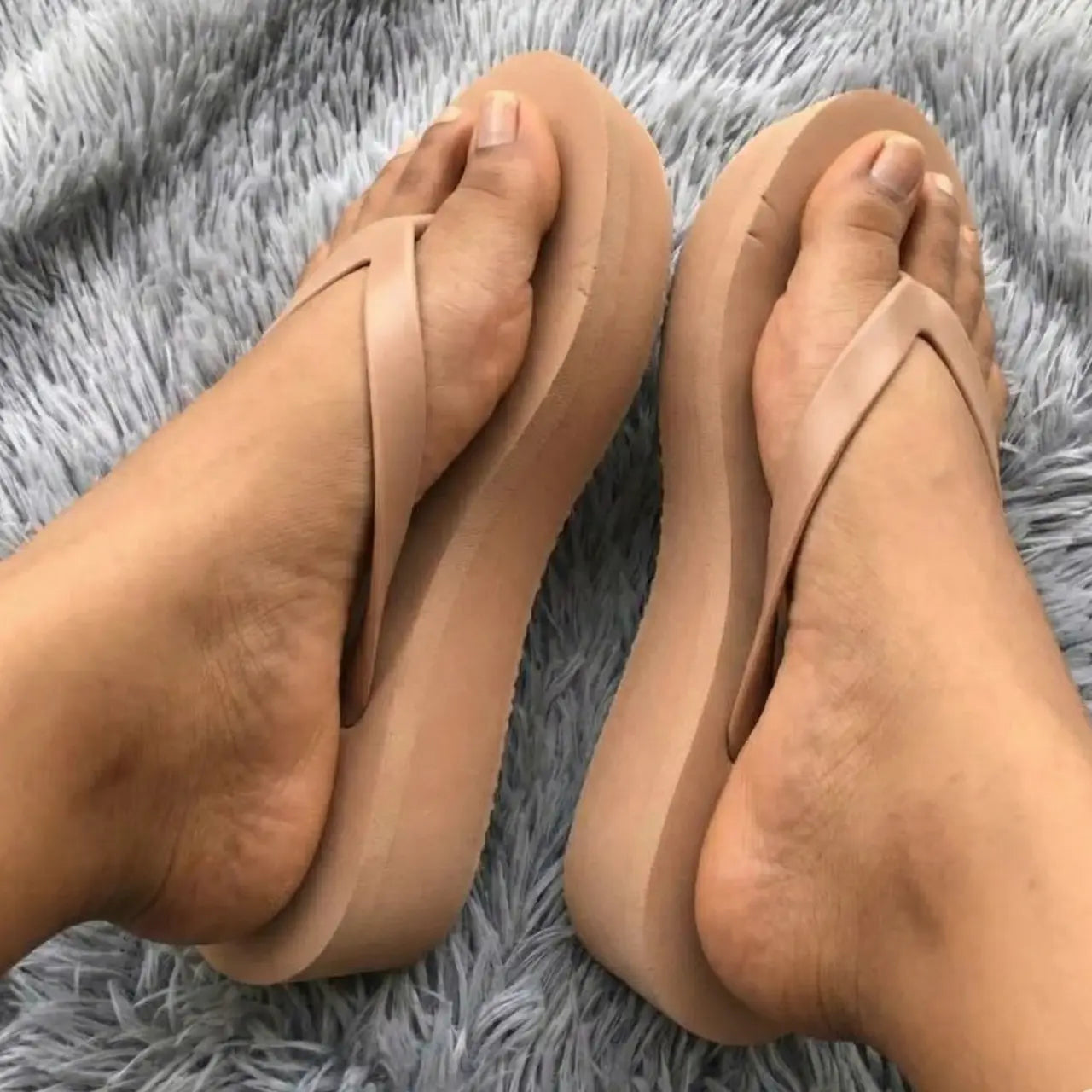 Solara Wedge Sandals – Stylish Women’s Flip Flops & Platform Summer Slides